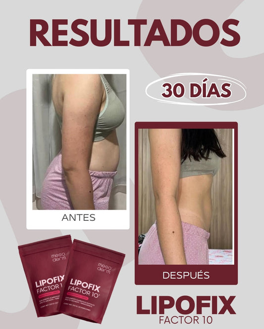 Lipofix Factor 10