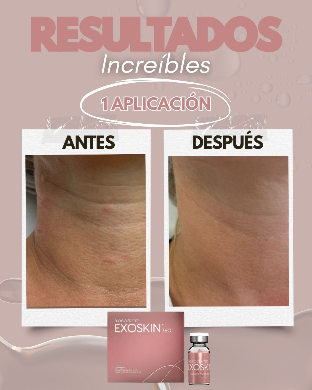 EXOSKIN 360