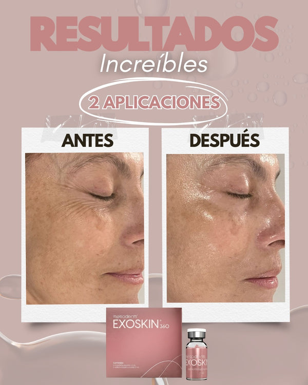 Después · 8 sem.