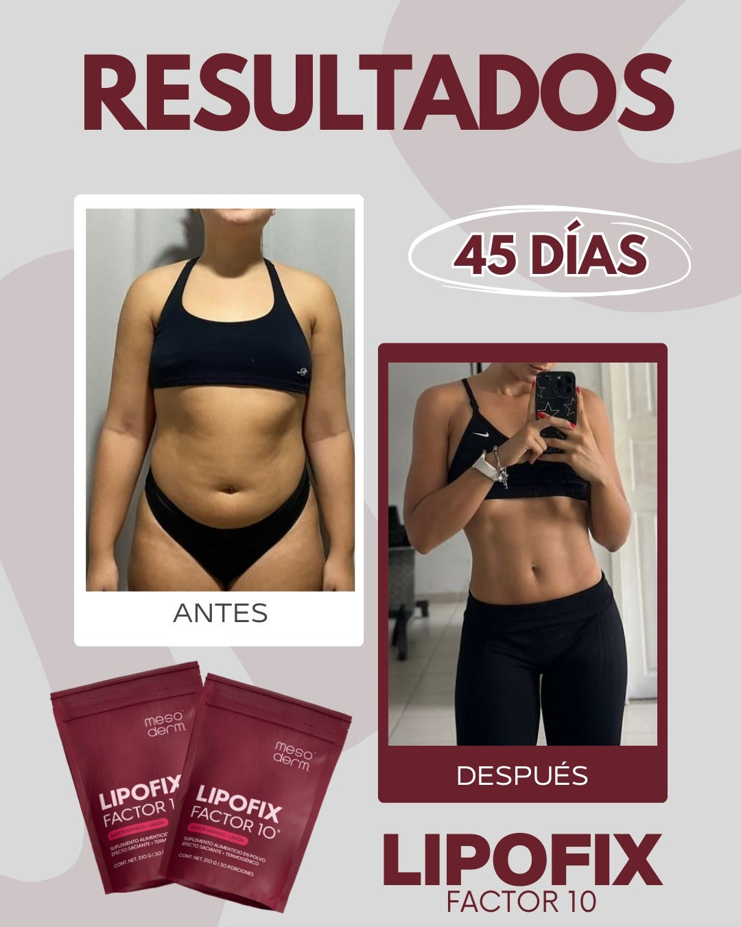 Lipofix Factor 10 Mayoreo