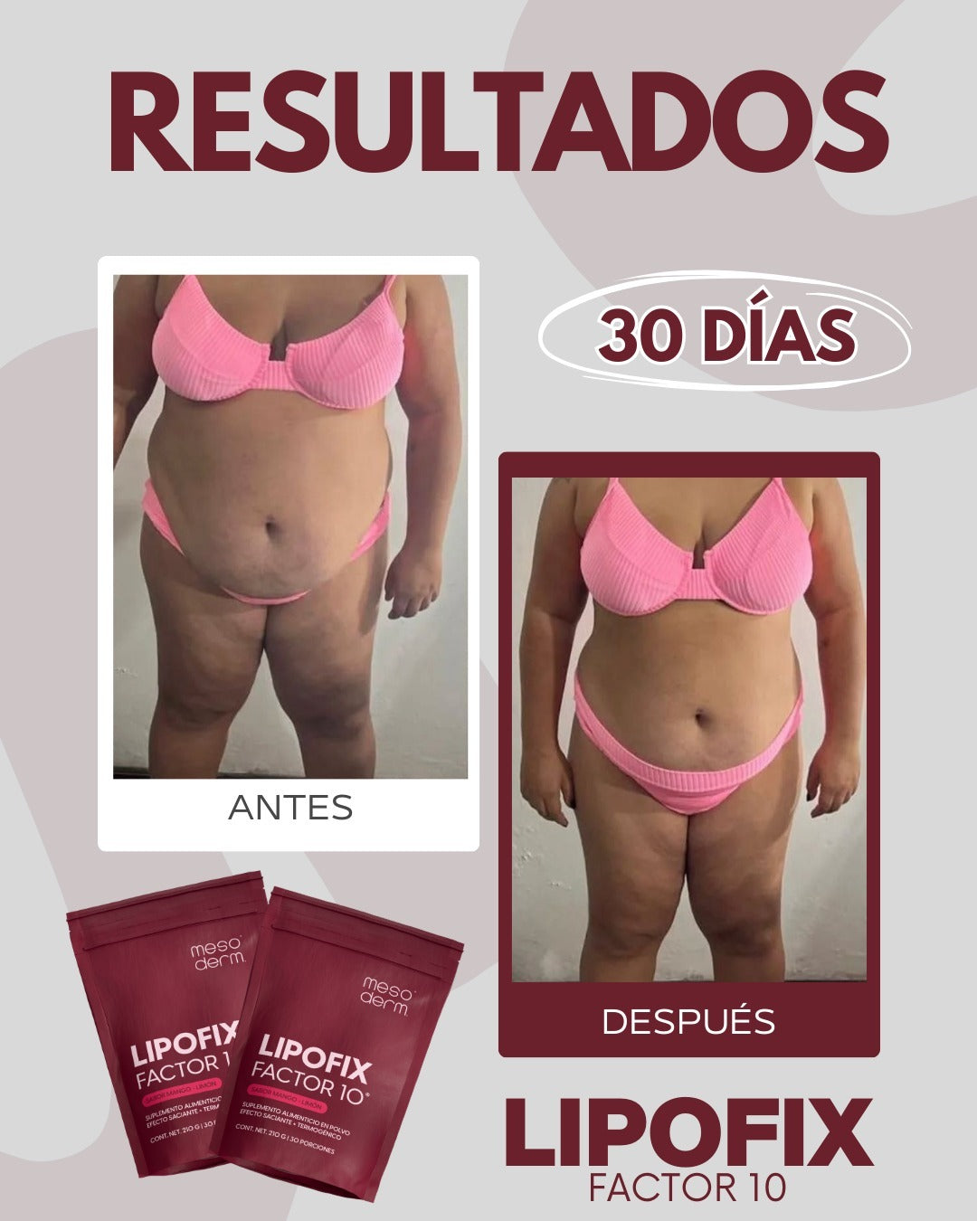 Lipofix Factor 10 Mayoreo