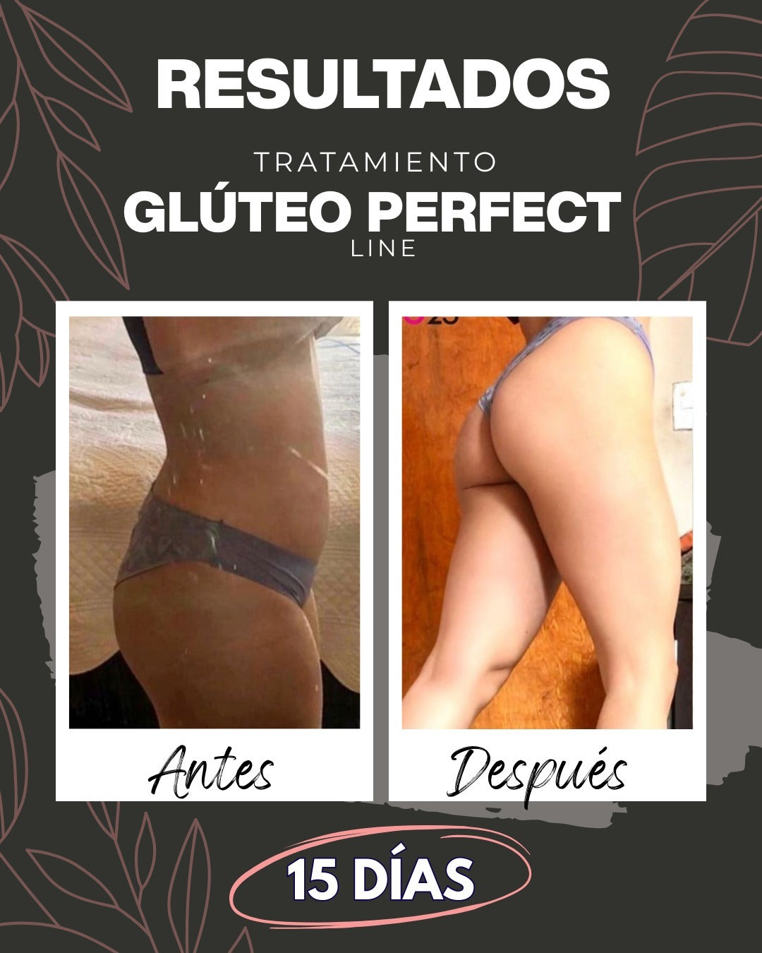 Tratamiento Glúteo Perfect Line