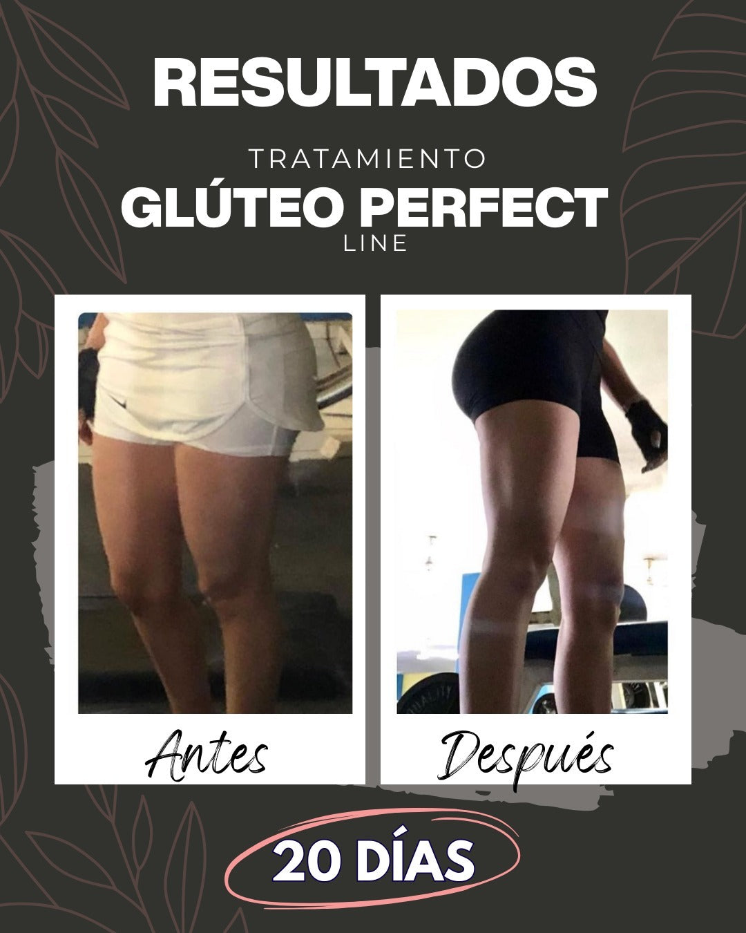 Tratamiento Glúteo Perfect Line