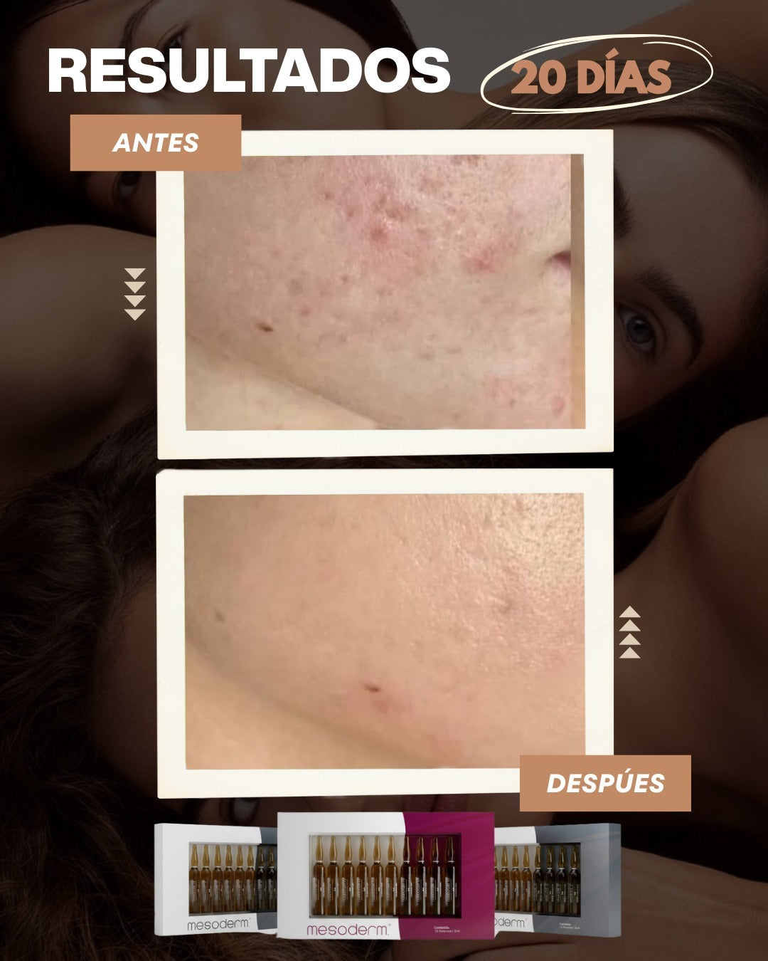 Tratamiento Facial Terapia Bioestimuladora + Antimanchas