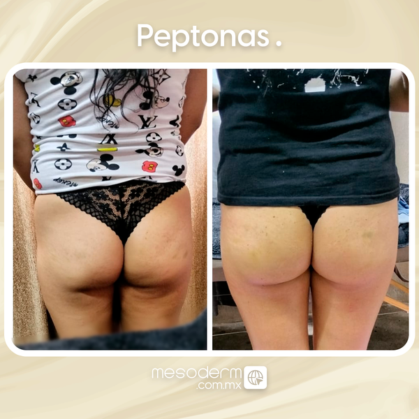 Después · 8 sem.