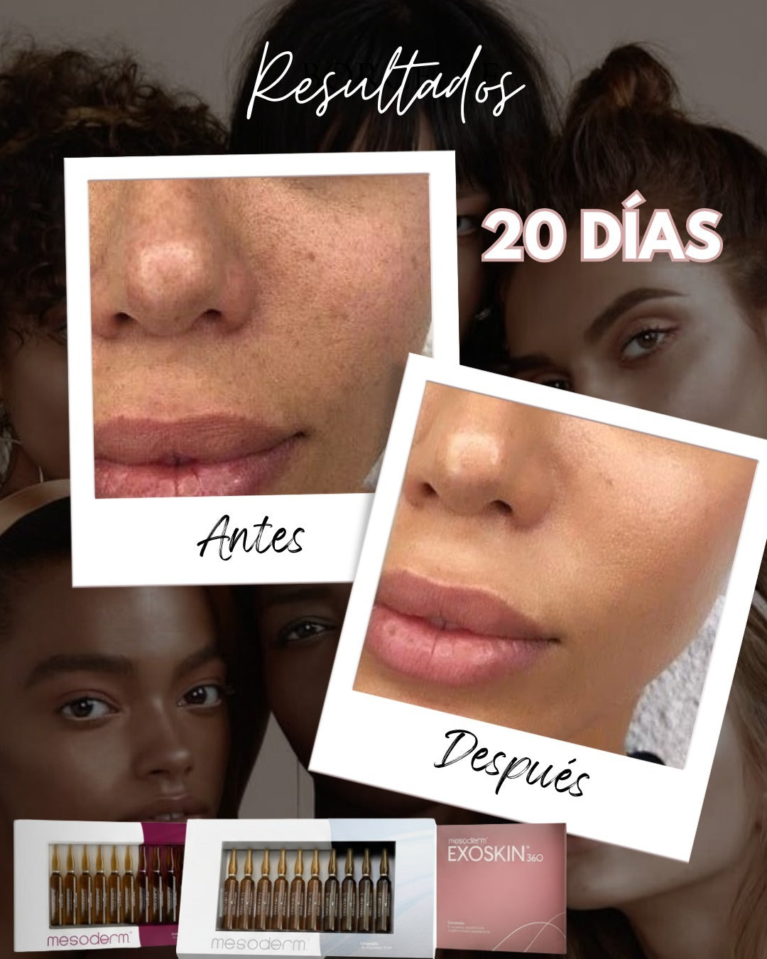 PROTOCOLO FASE 3 – REJUVENECIMIENTO FACIAL 360° MESODERM