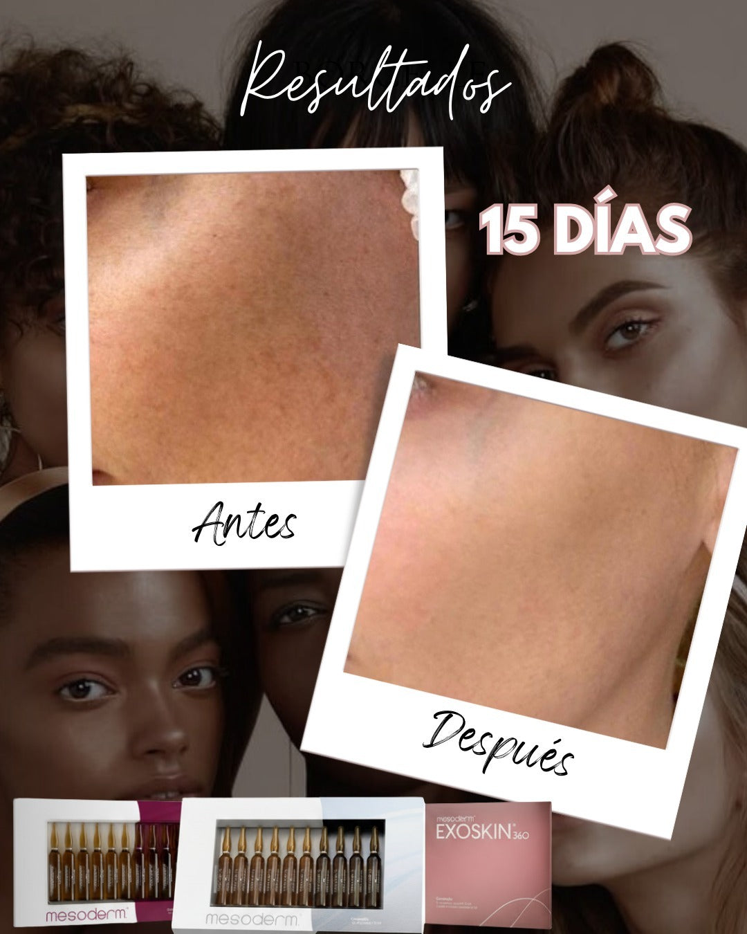 PROTOCOLO FASE 3 – REJUVENECIMIENTO FACIAL 360° MESODERM