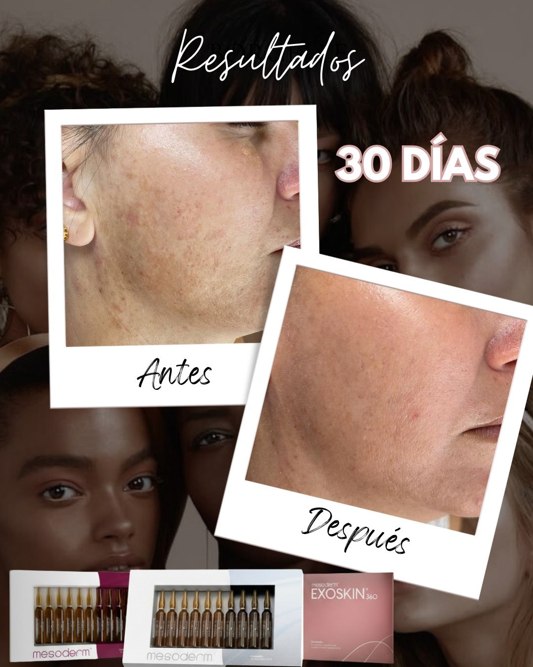 PROTOCOLO FASE 3 – REJUVENECIMIENTO FACIAL 360° MESODERM
