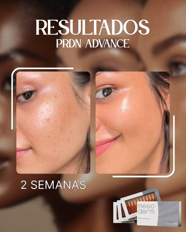 Después · 10 sem.