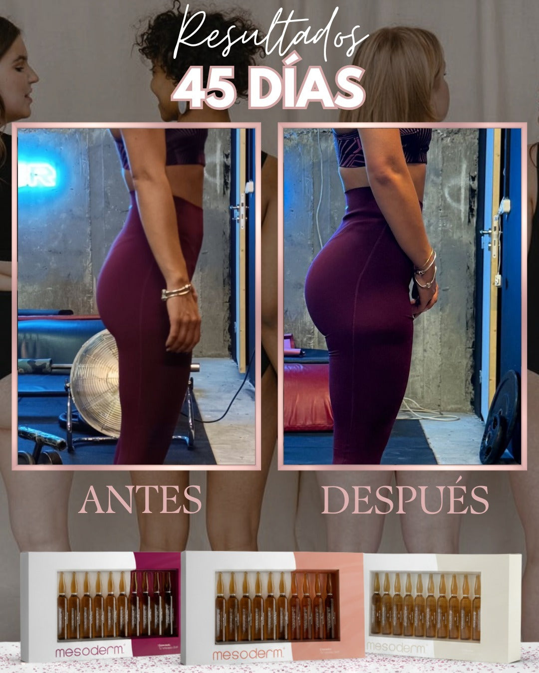 PROTOCOLO TRIFÁSICO VOLUMEN & PROYECCIÓN GLÚTEA MESODERM