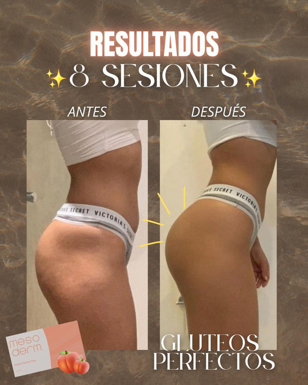 Después · 12 sem.