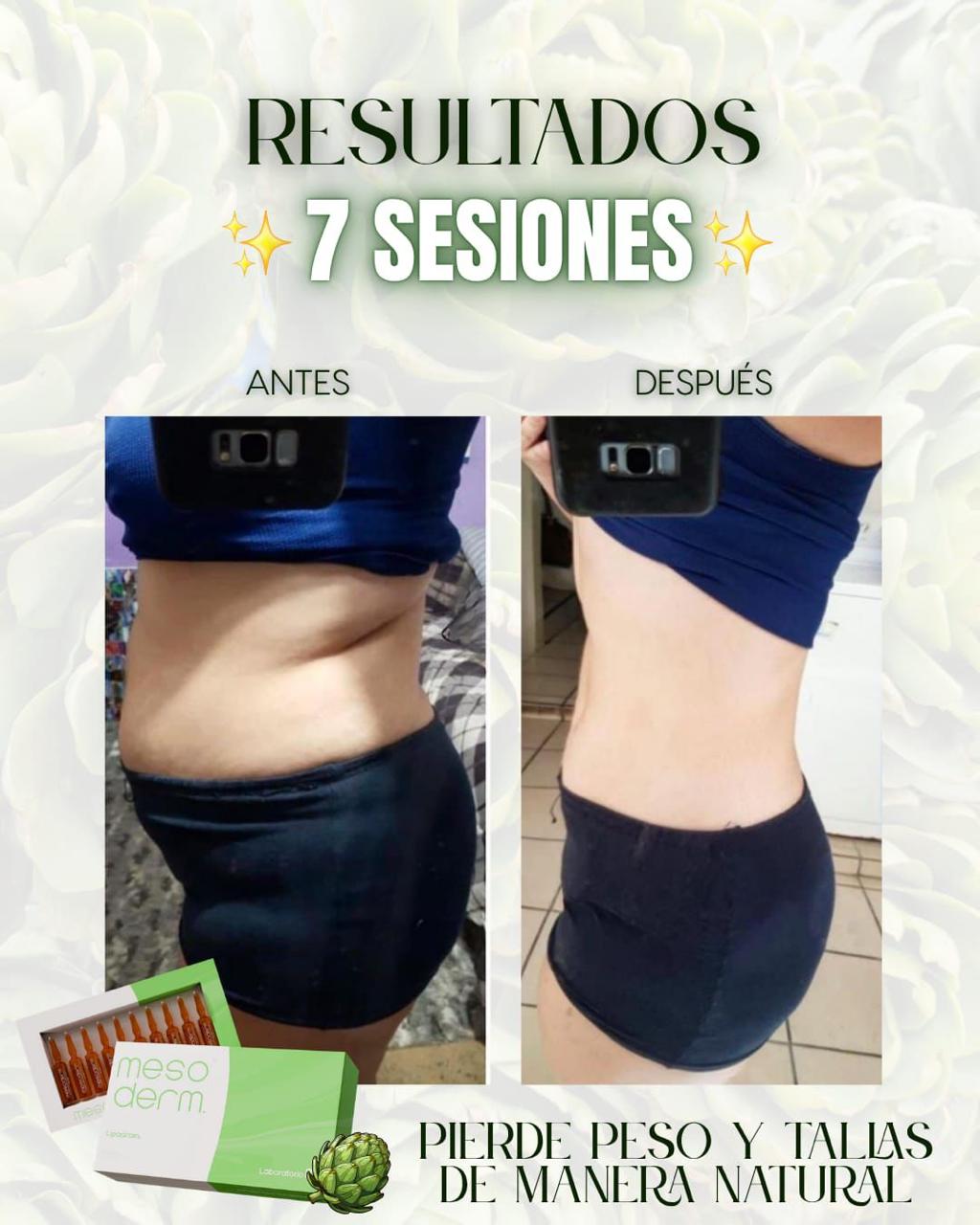 Lipodrain
