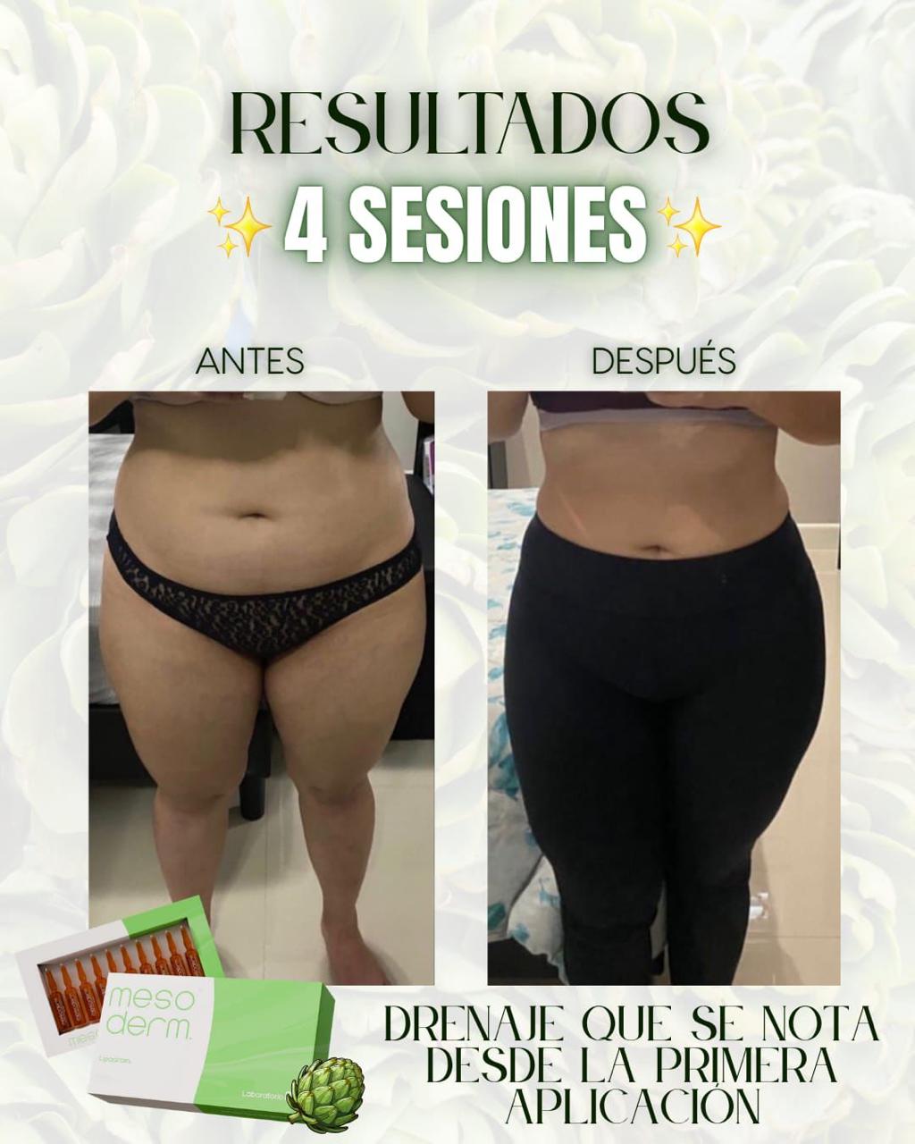 Lipodrain