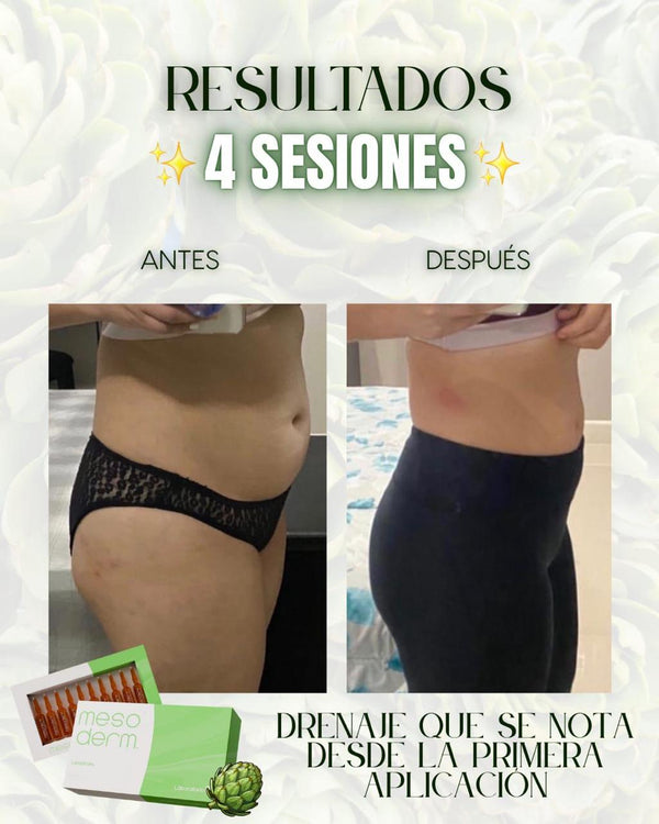 Antes