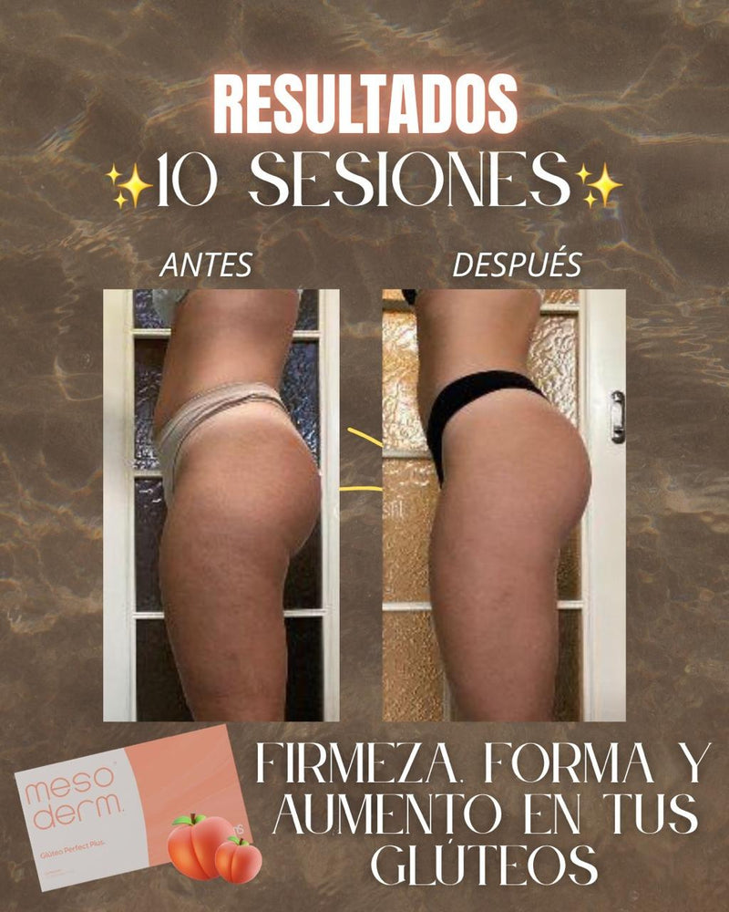 Antes y después · Valeria T.