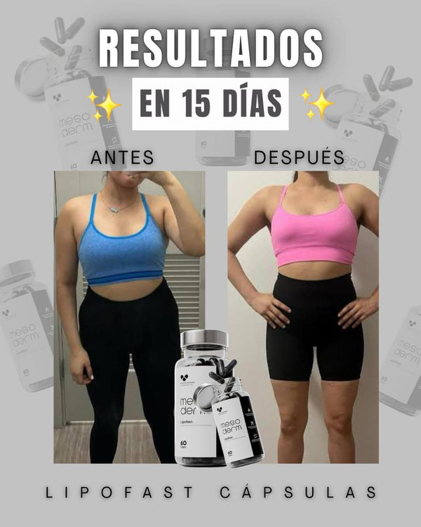 Antes