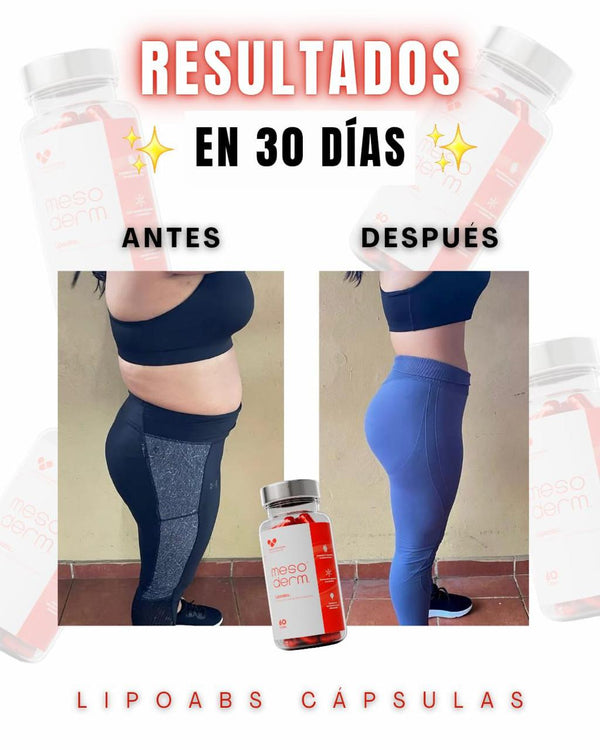 Antes