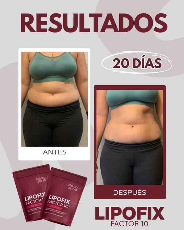 Antes