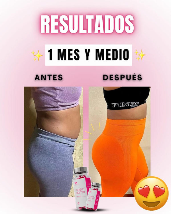 Después · 12 sem.