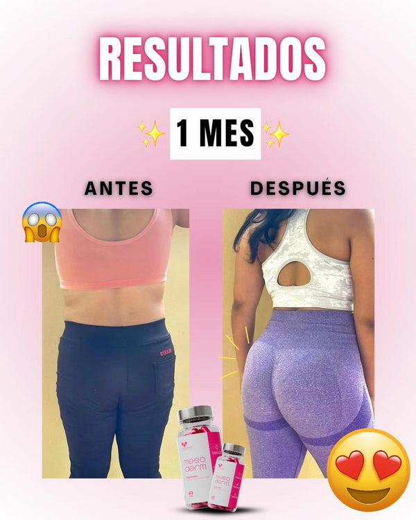 Antes