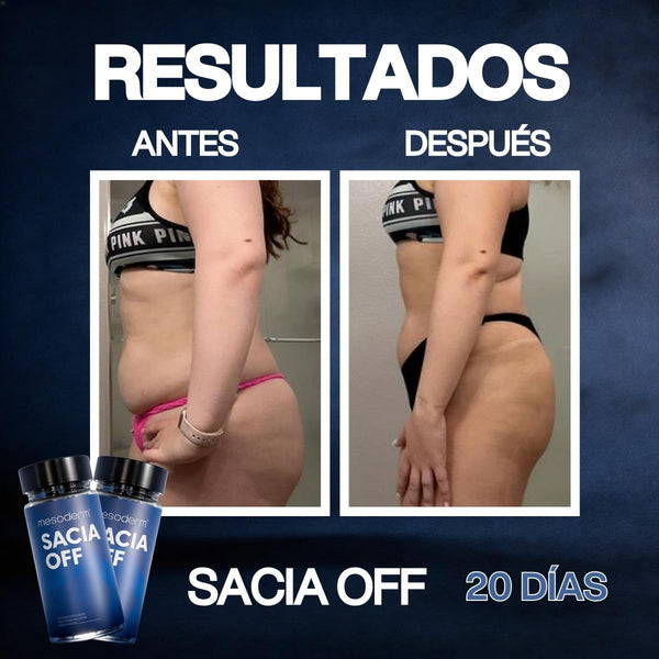 Antes