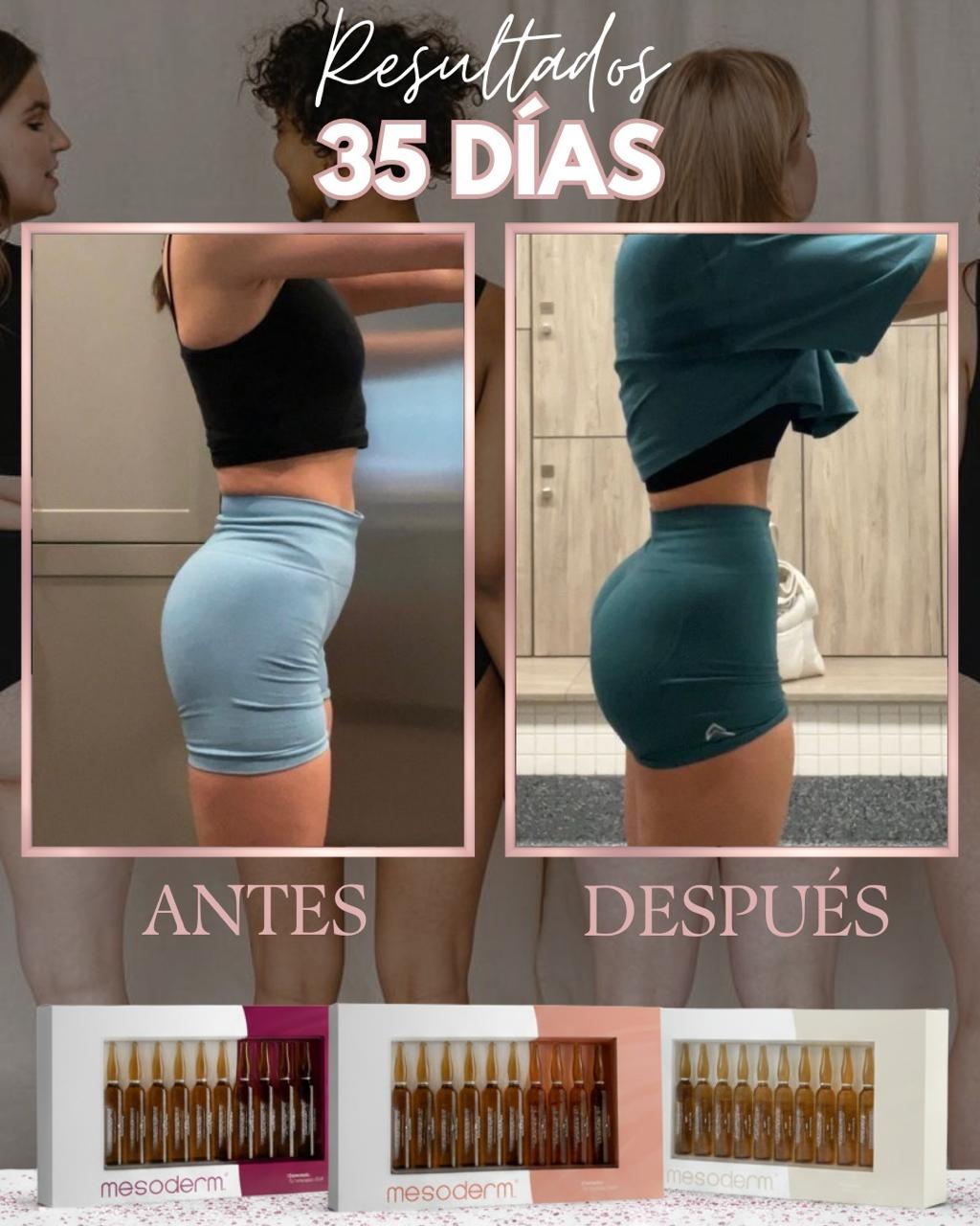 PROTOCOLO TRIFÁSICO VOLUMEN & PROYECCIÓN GLÚTEA MESODERM