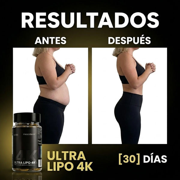 Antes
